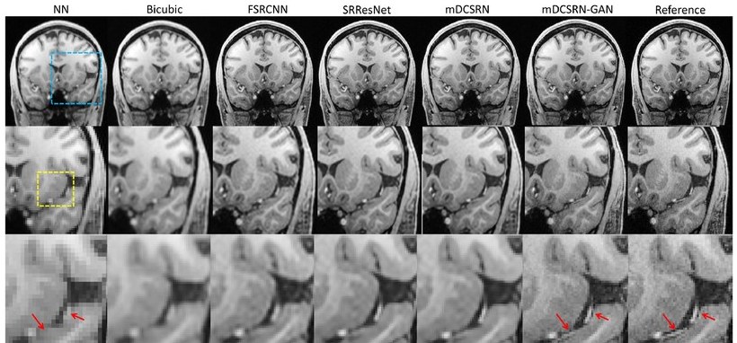 Brain-MRI super-resolution: nearest-neighbour and bicubic interpolation through FSRCNN, SRResNet, mDCSRN, and our mDCSRN-GAN, next to the ground-truth reference.
