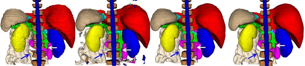 3D renderings of automatically segmented abdominal organs — liver, spleen, kidneys and pancreas — from manual labels through the network variants.